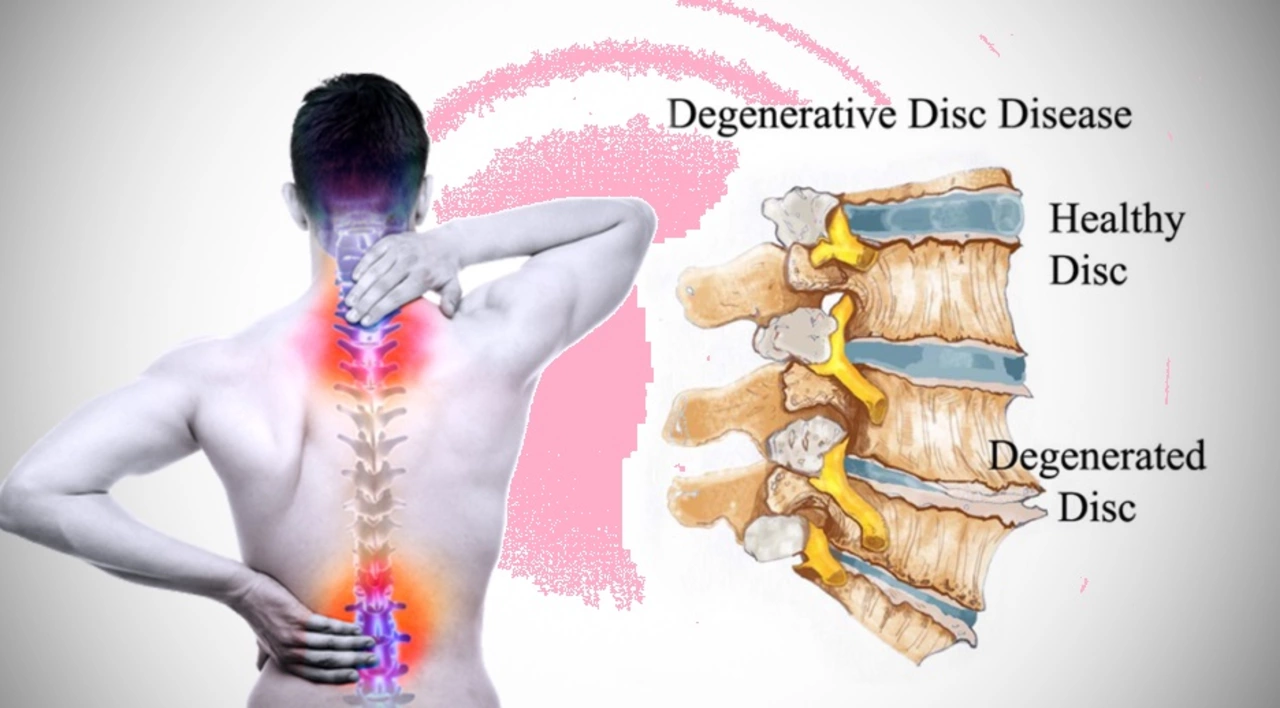 The Impact of Osteodystrophy on Spinal Health and Function